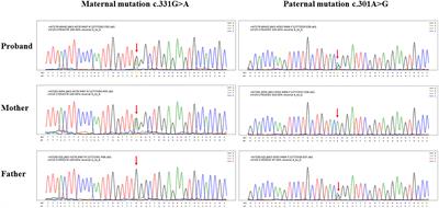 Case Report: Mutations in JAK3 causing severe combined immunodeficiency complicated by disseminated Bacille Calmette–Guérin disease and Pneumocystis pneumonia